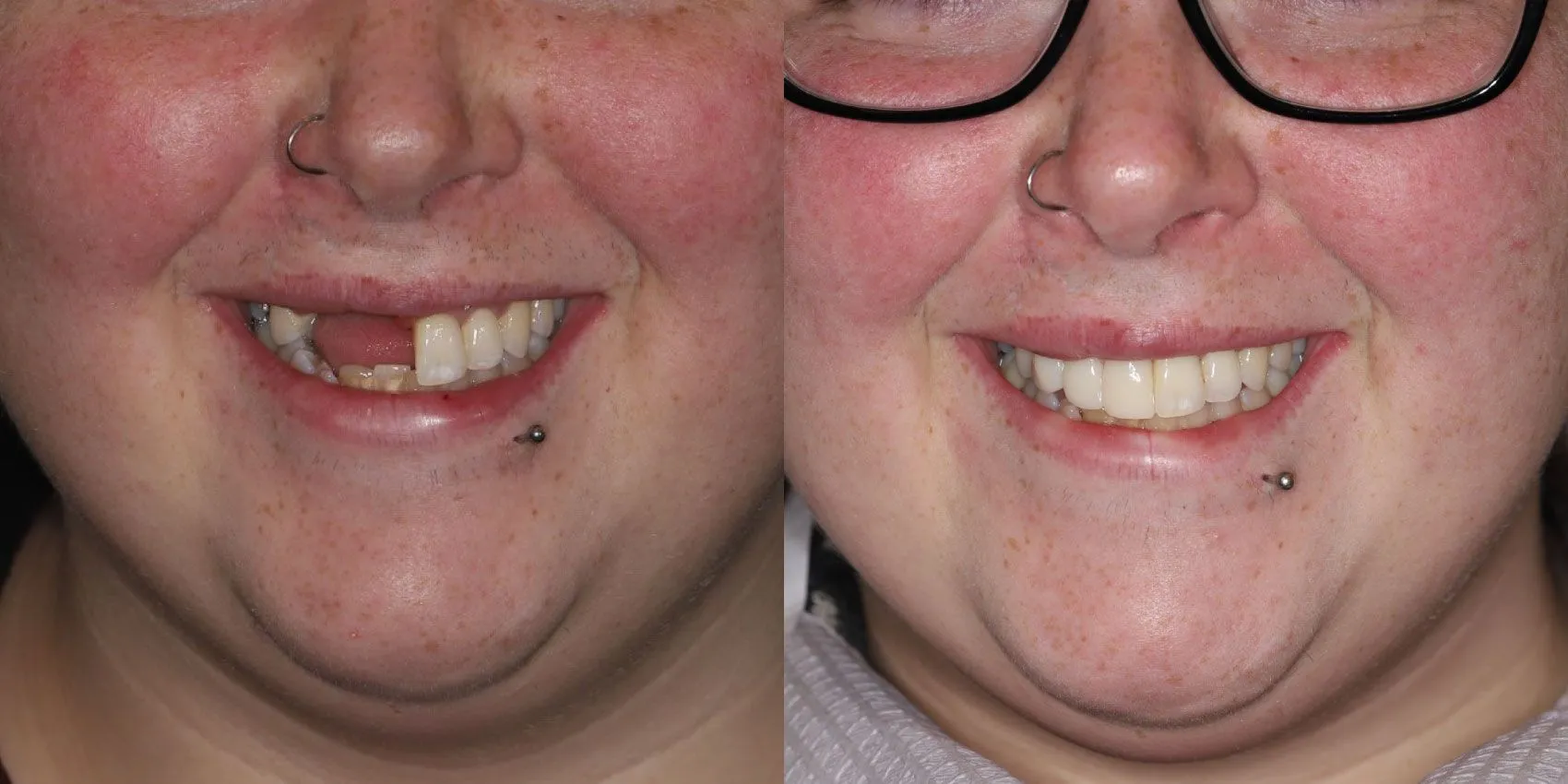 Before After Image