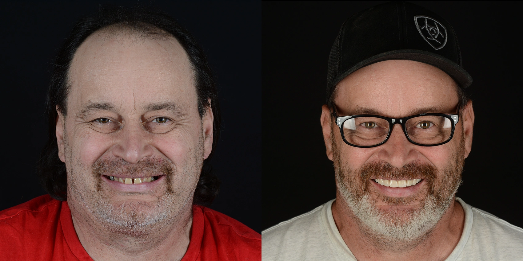 Before After Image