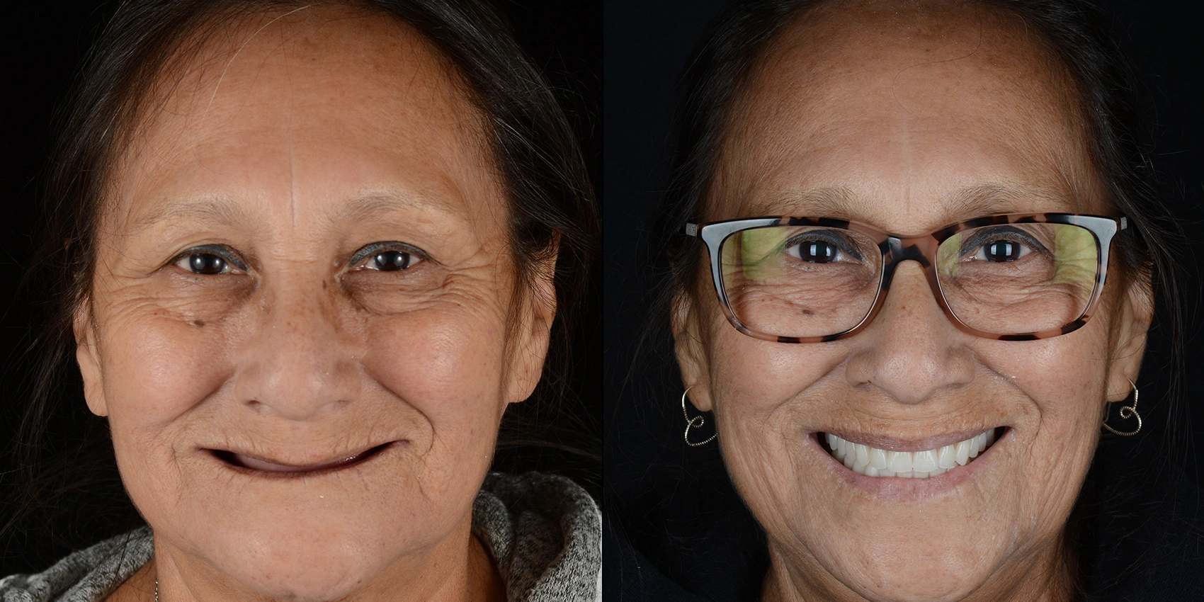 Before After Image