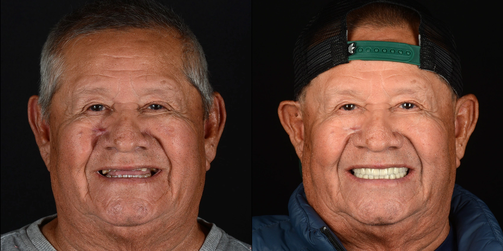 Before After Image