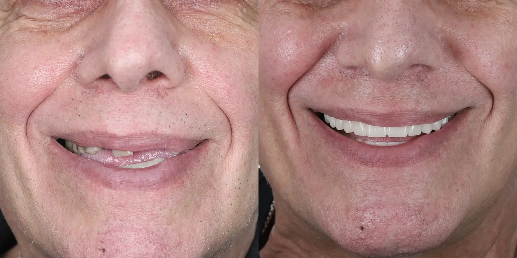 Before After Image