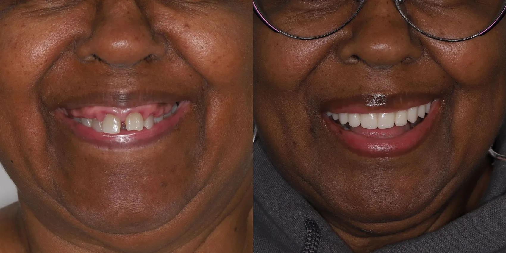 Before After Image
