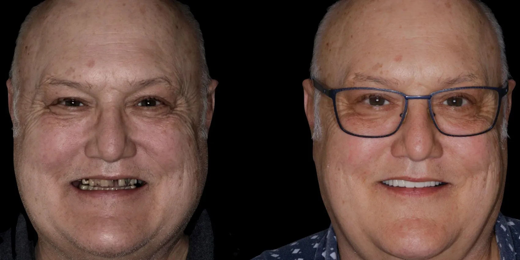 Before After Image