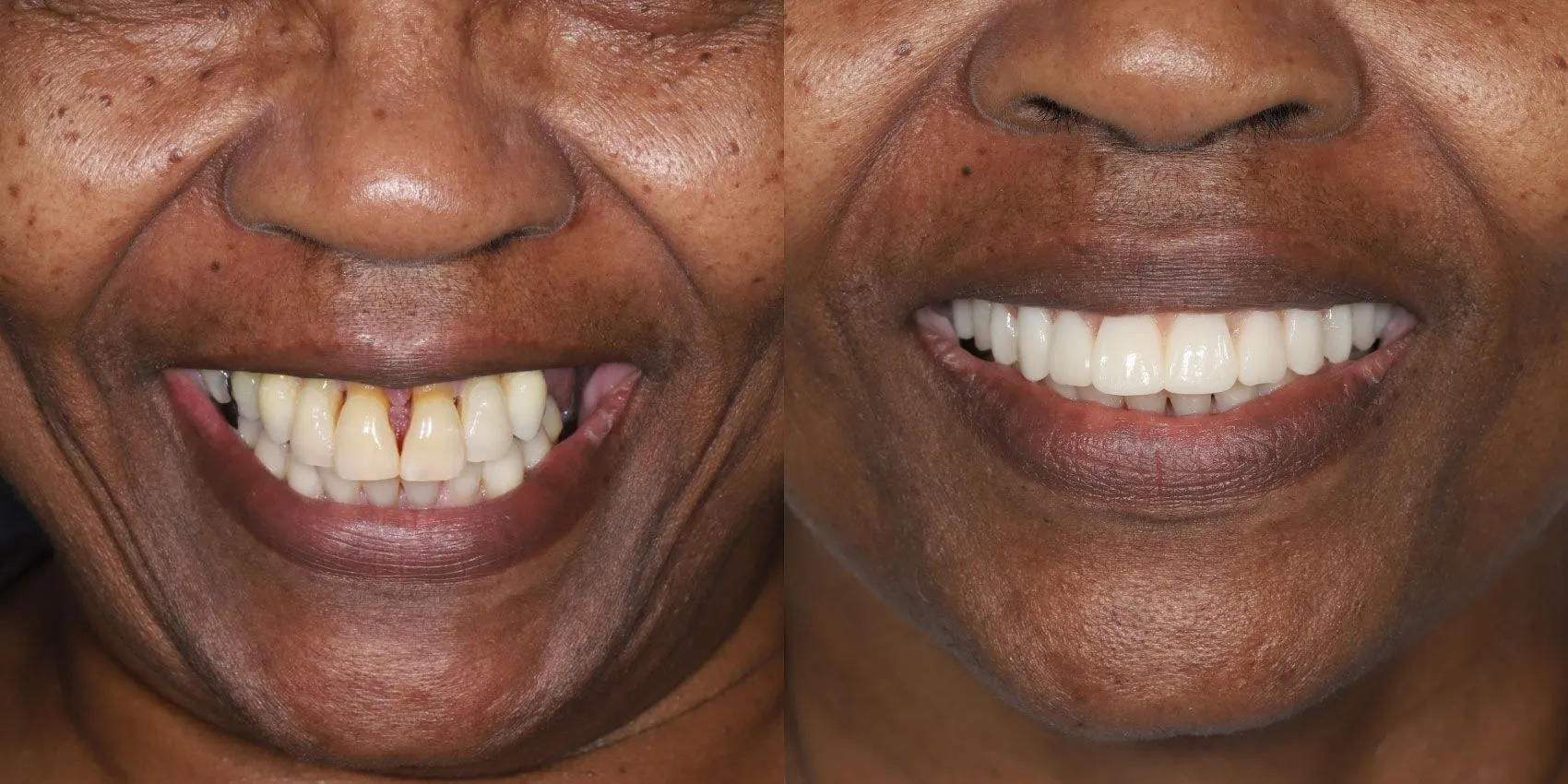 Before After Image