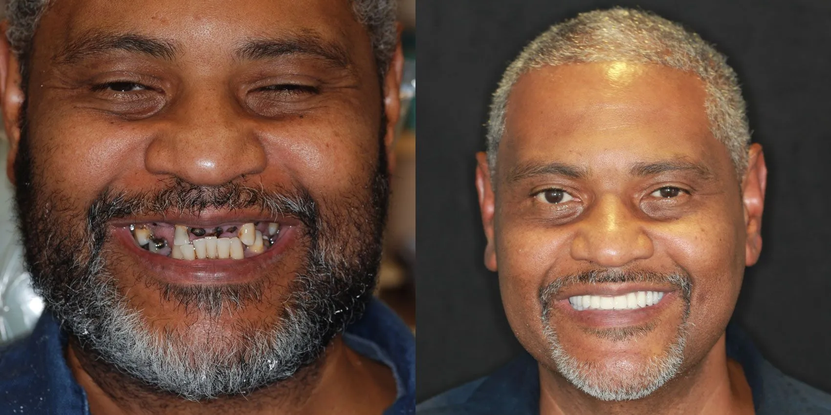 Before After Image
