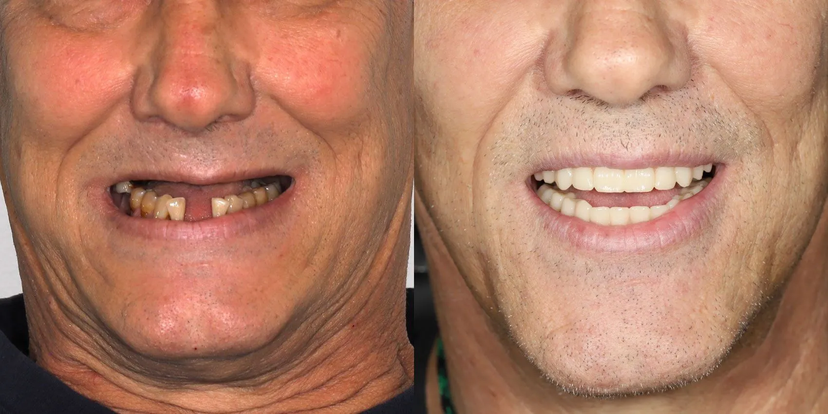 Before After Image