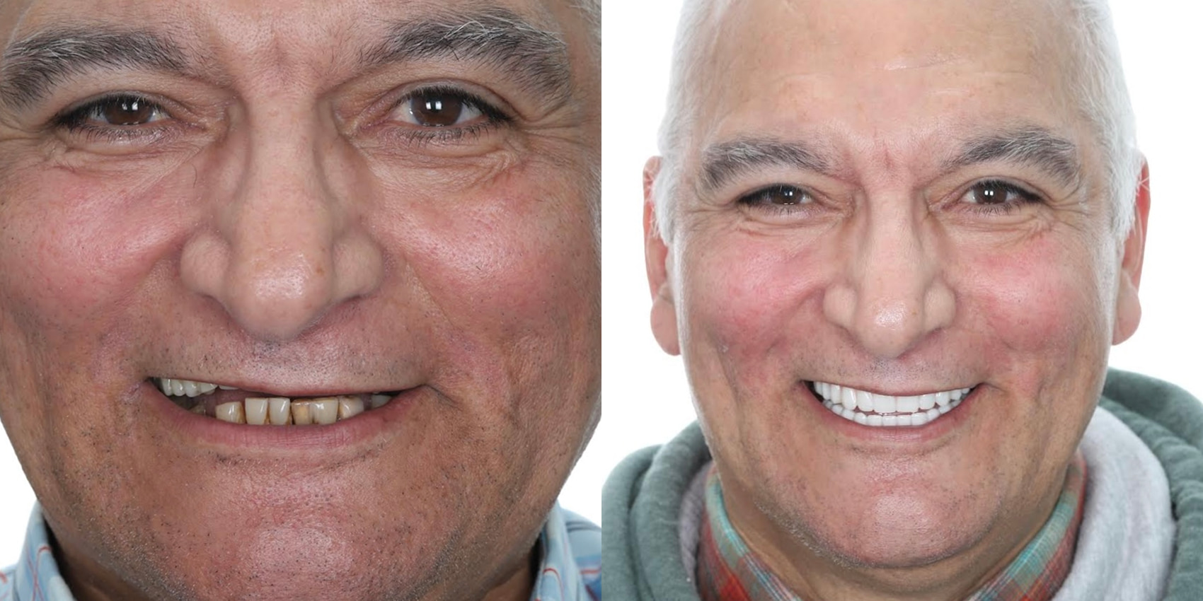 Before After Image