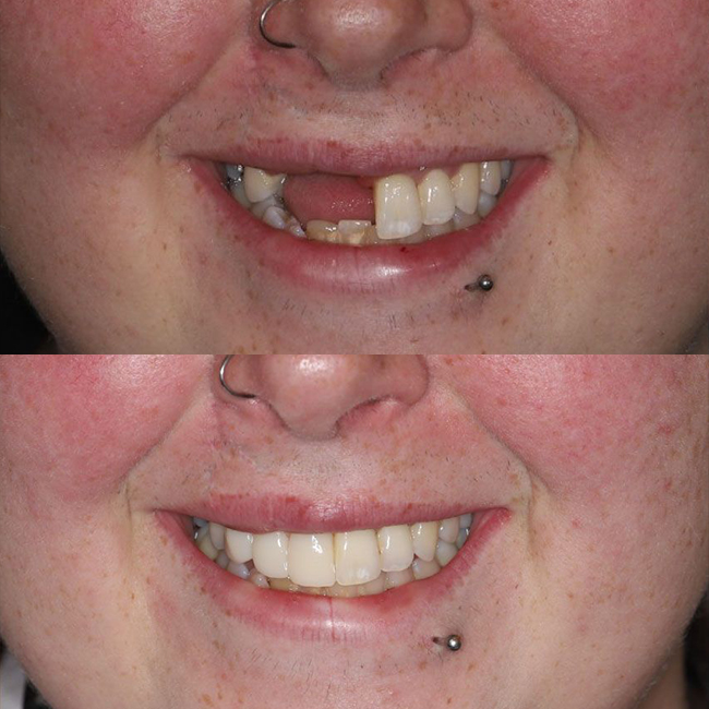 Before After Image